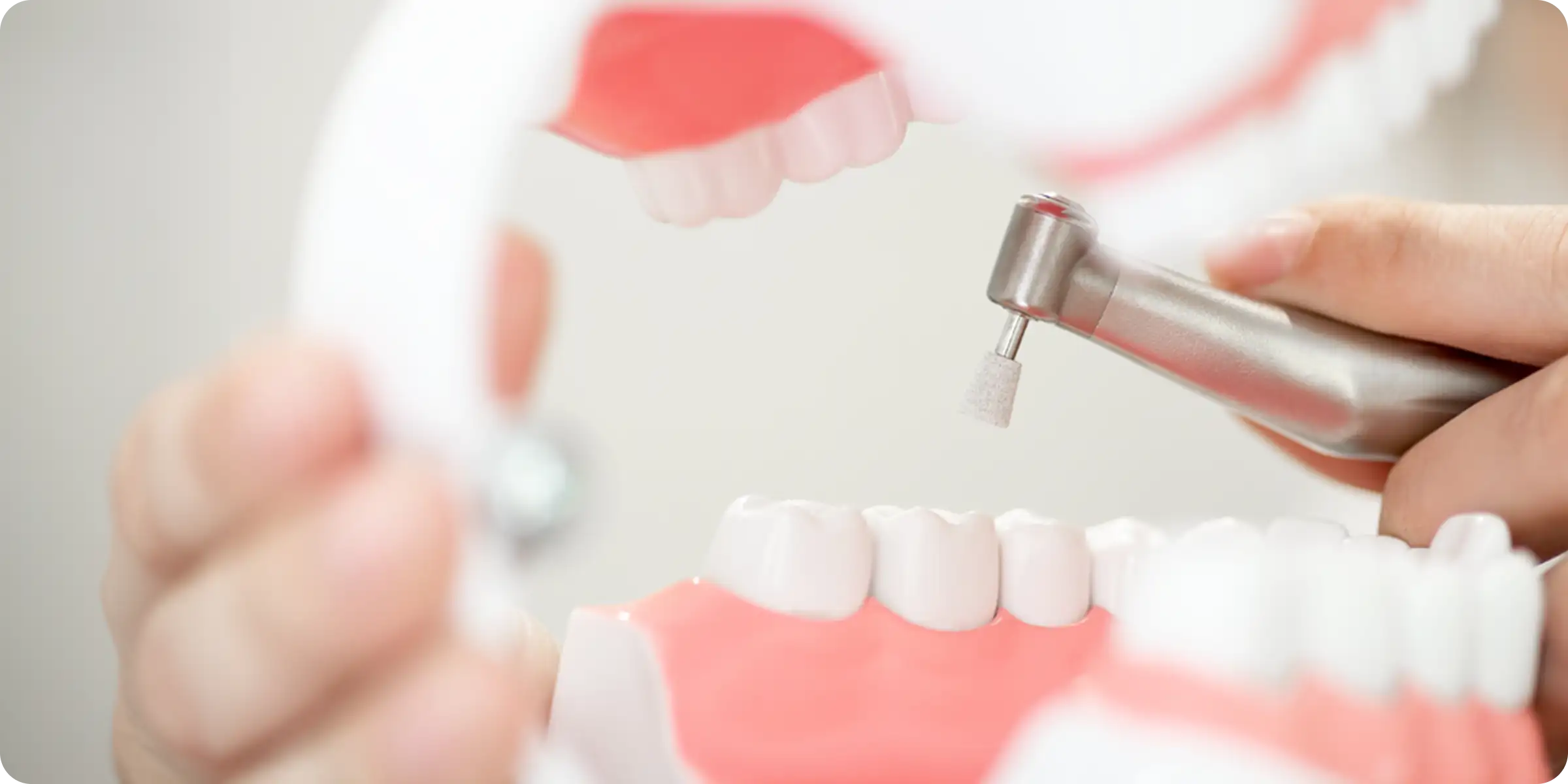 closeup-prosthodontics-prosthetic-crown-bridge-equipment-model-express-fix-restoration 1