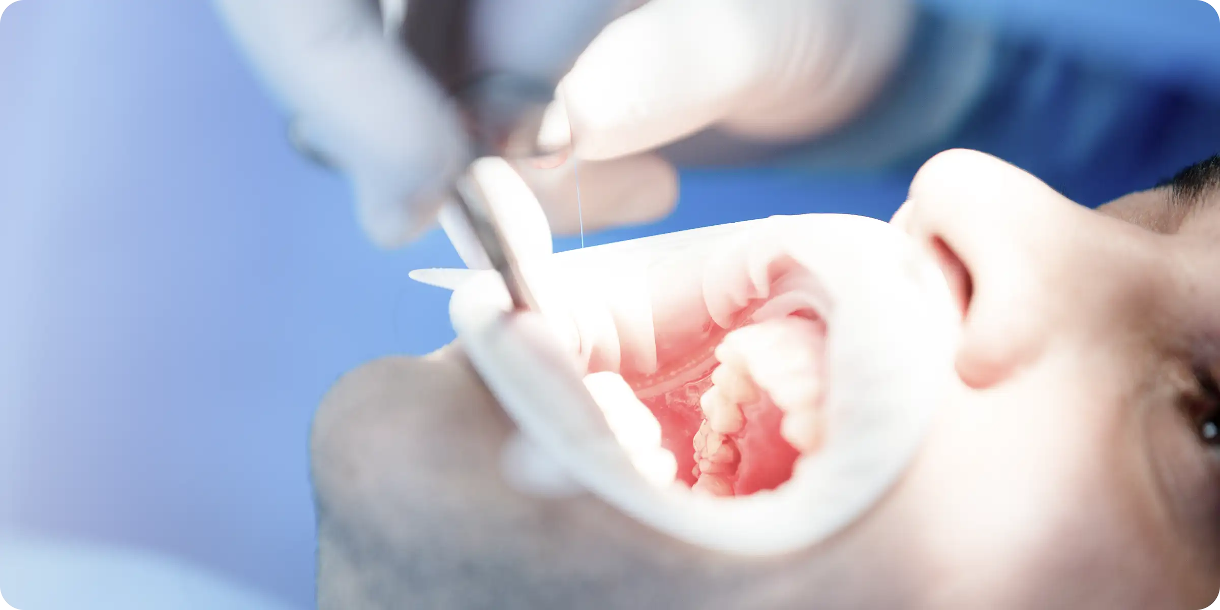 closeup-prosthodontics-prosthetic-crown-bridge-equipment-model-express-fix-restoration 2